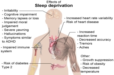 sleep_deprivation